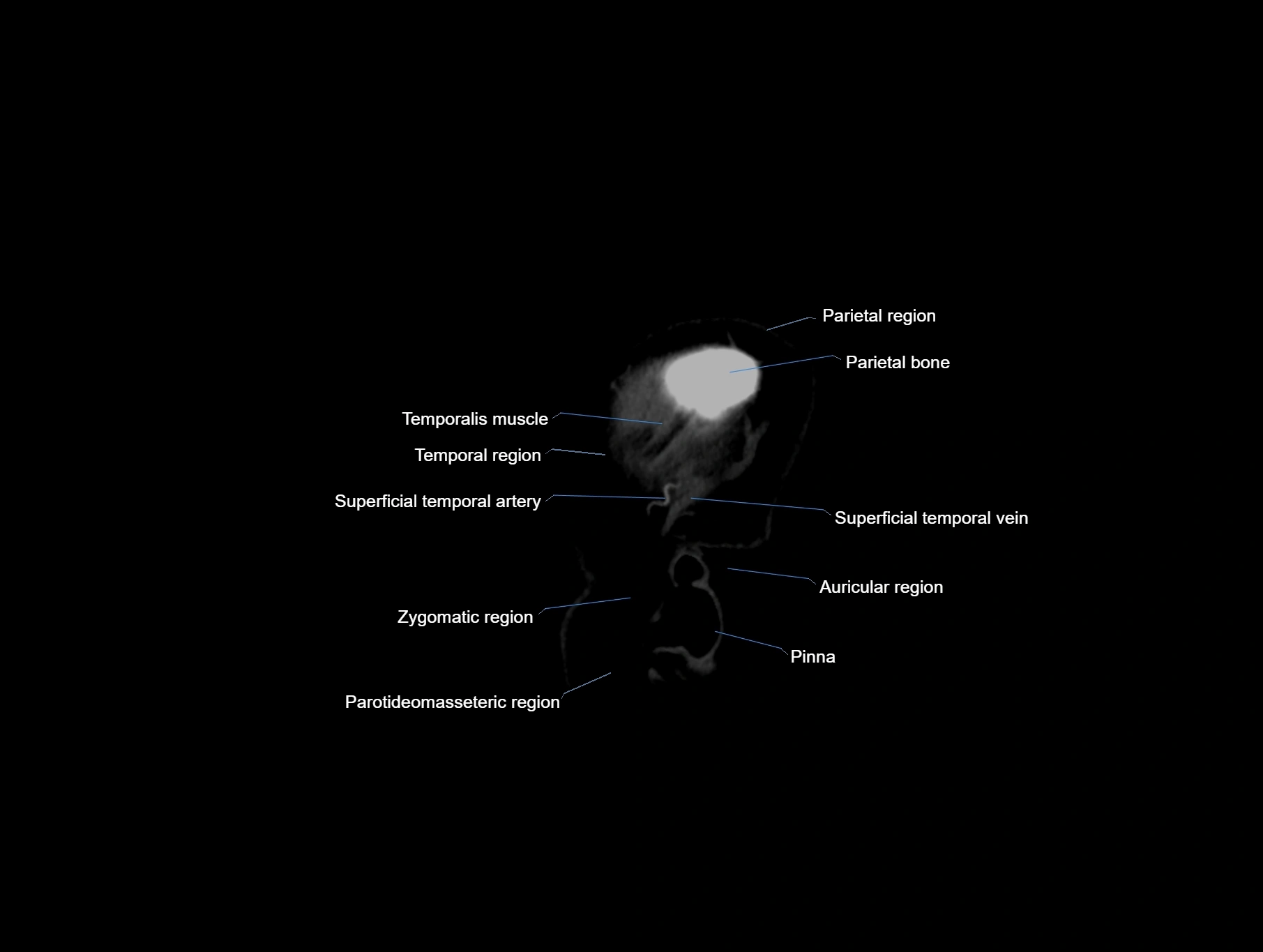 CT scan brain sagittal cross sectional anatomy image-img-00001-00002.webp